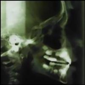 Apulanta - Aivan Kuin Kaikki Muutkin (CD)